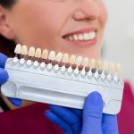 Porselen Kaplama Nasıl Yapılır? - Polident Diş Polikliniği