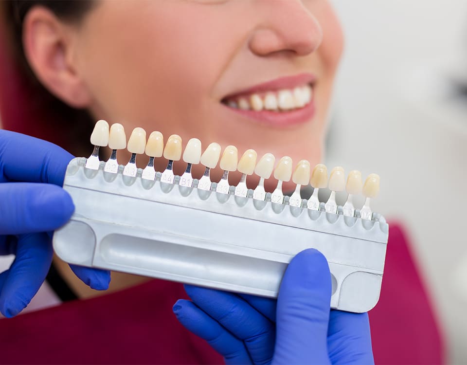 Porselen Kaplama Nasıl Yapılır? - Polident Diş Polikliniği