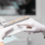 Porselen Kaplama Kaç Yıl Dayanır? - Polident Diş Polikliniği