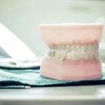 Diş Kaybında Protez Seçimi Nasıl Yapılır? - Bayrampaşa Polident Diş Polikliniği