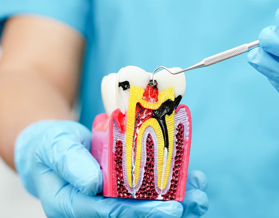 Bayrampaşa Kanal Tedavisi - Polident Diş Polikliniği