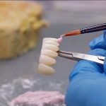 Bayrampaşa Kuron Tedavisi - Polident Diş Polikliniği