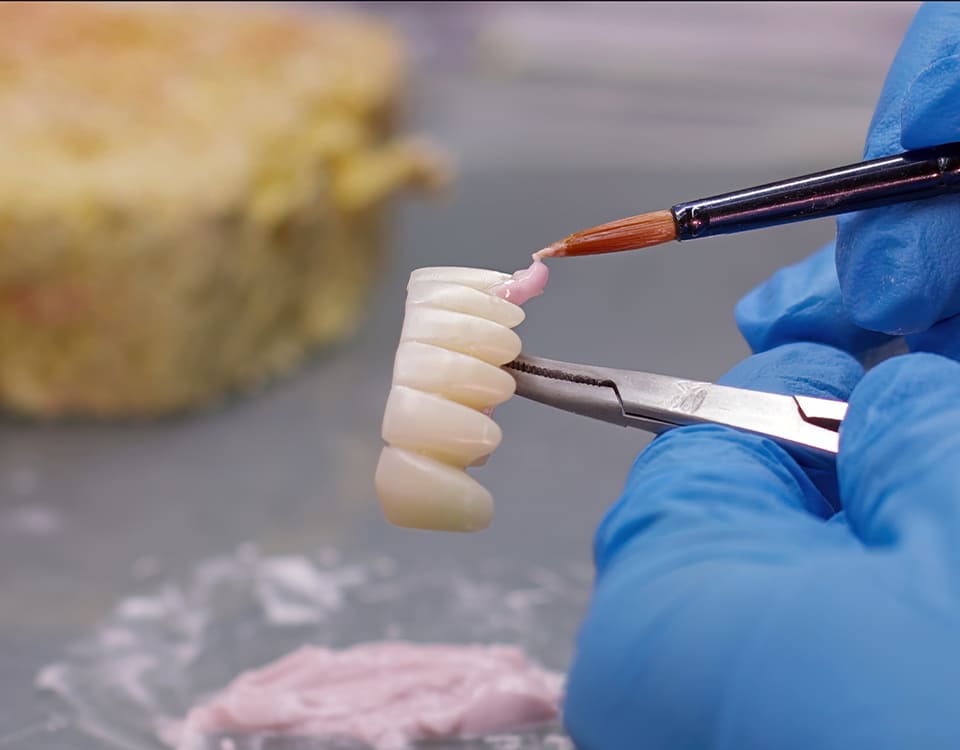 Bayrampaşa Kuron Tedavisi - Polident Diş Polikliniği