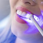 Bayrampaşa Diş Beyazlatma Fiyatları - Polident Diş Polikliniği